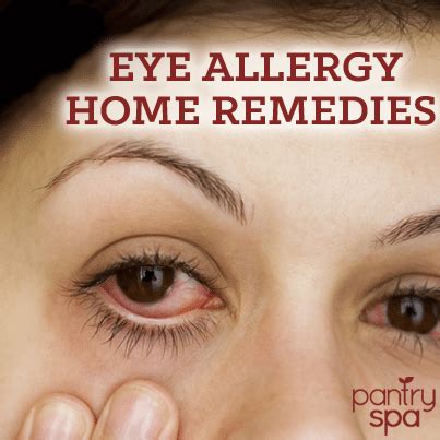 Eye Allergies: Natural Remedies For Itchy, Red & Watery Eyes