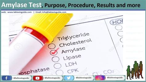 Amylase (Serum) Test Purpose, Procedure, Result and more | Lab Tests Guide