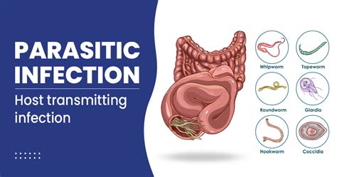 Parasite In Stomach Symptoms