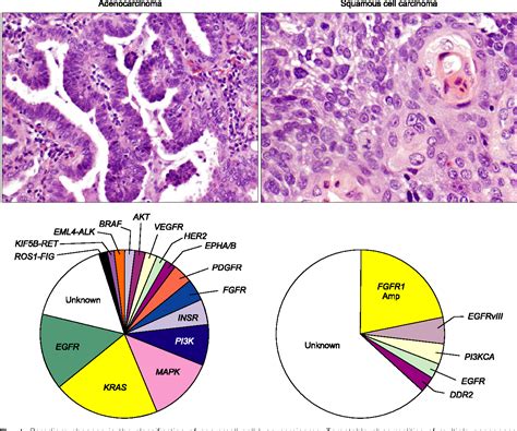 [PDF] MOLECULAR ABNORMALITIES OF SQUAMOUS CELL CARCINOMAS AND ADENOCARCINOMAS OF THE LUNG ...