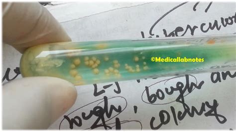 Mycobacterium Tuberculosis Introduction Morphology Pathogen – NBKomputer