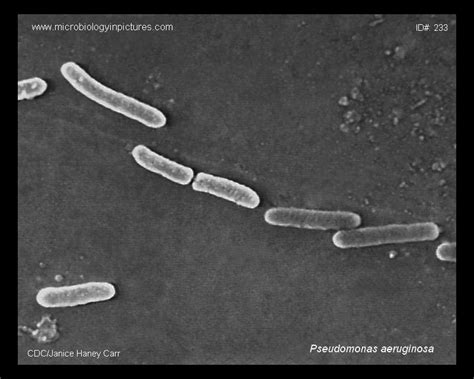 Pseudomonas aeruginosa – scheda batteriologica ed approfondimenti