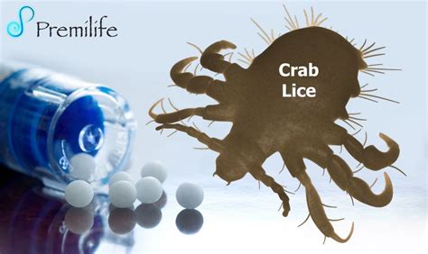 Crab Lice - Premilife - Homeopathic Remedies