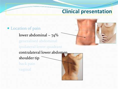 Relieve lower back hip pain causes, hip dysplasia symptoms in adults jokes, hip pain ectopic ...