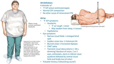 Idiopathic intracranial hypertension (pseudotumor cerebri)