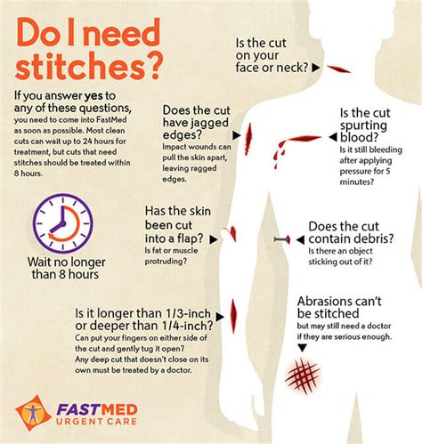 Do I Need Stitches? [INFOGRAPHIC] - FastMed