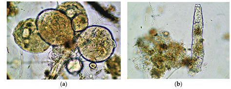 Observed microorganisms of activated sludge: (a) Stalked ciliates; (b)... | Download Scientific ...