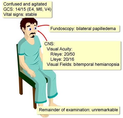 Pituitary Apoplexy - Interactive case study | Clinical Odyssey by ...