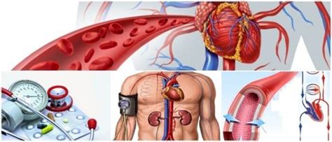 Urgencia Hipertensiva: Causas, Sintomas, Diagnóstico, Tratamiento y Recomendaciones - Arriba Salud