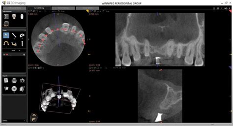 Cone Beam CT Scan Winnipeg Manitoba, Winnipeg Periodontal Group