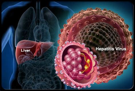 Hati - Hati, Penyakit Hepatitis Bisa Menyerang Tanpa Rasa Sakit ...