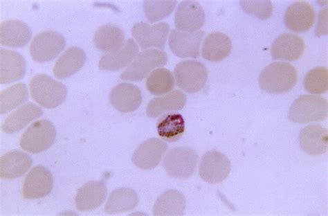 Free picture: thin, film, blood smear, micrograph, mature, band, form, plasmodium malariae ...