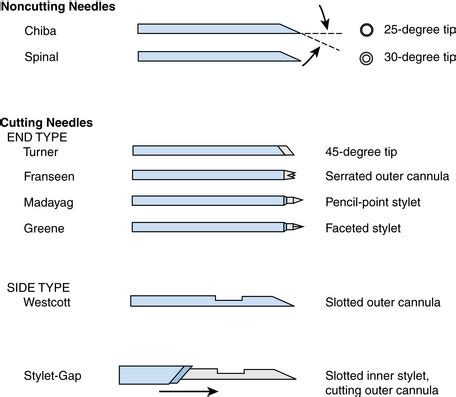 Percutaneous biopsy | Radiology Key