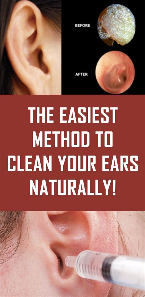 The Easiest Method To Clean Your Ears Naturally! | Cleaning your ears, Blocked ear remedies, Dry ...