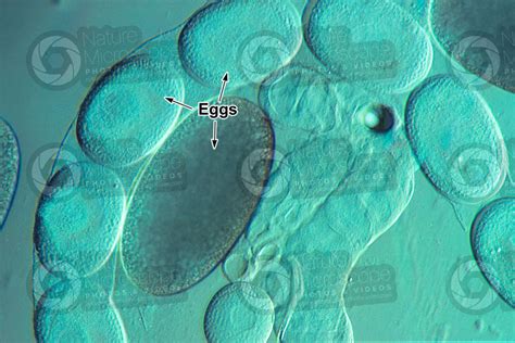 Tunga penetrans. Chigoe flea. Tungiasis. 40X - Fleas - Insecta (Insects) - Ectoparasites ...