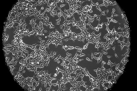 Optimized Cell Culture Medium For Scalable Viral Vector Production