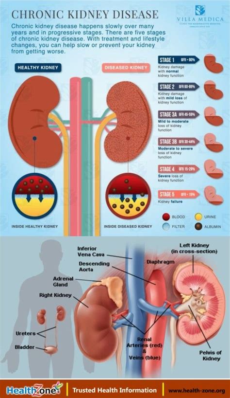 The Kidneys (Human Anatomy): Function, Diseases, Medical Tests ...