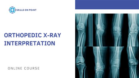 Orthopedic X-Ray Interpretation | Skills On Point, LLC