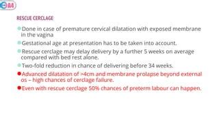 Cervical cerclage procedure | PPT