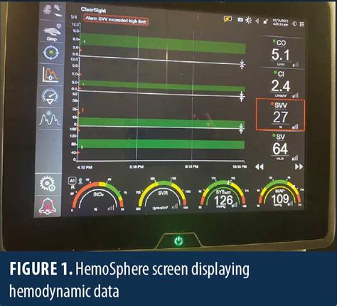 Adapting Advanced Hemodynamic Monitoring to Optimize Surgical Outcomes in Bariatric Surgery ...