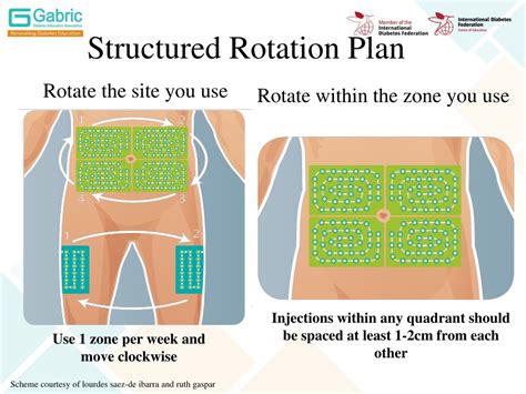 PPT - Insulin Injection: Guidelines and Practical Aspects PowerPoint Presentation - ID:474676