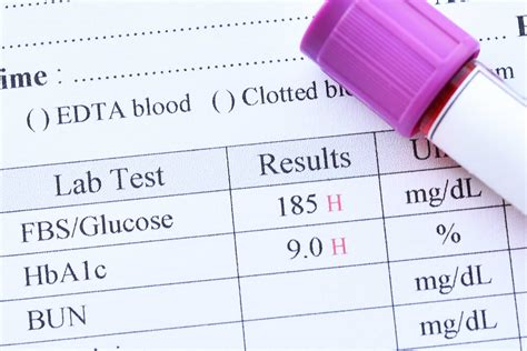 The Way To Diagnose Diabetes With Blood Test Results - Danisola