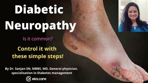 Diabetic Neuropathy: foot pain Symptoms, Causes, Treatment & Control ...