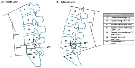 JCM | Free Full-Text | Pain Control Affects the Radiographic Diagnosis of Segmental Instability ...