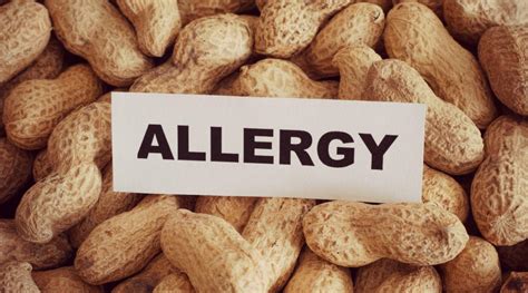 Peanut Allergy