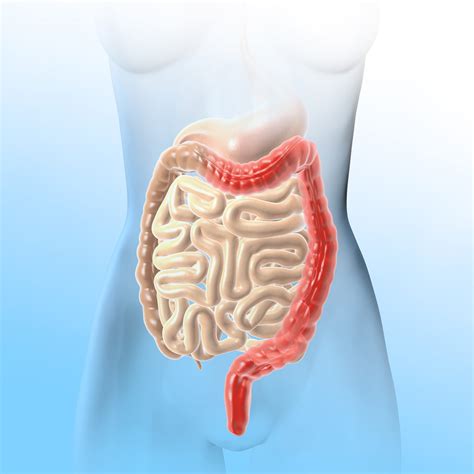 Ulcerative Colitis - UNION Therapeutics