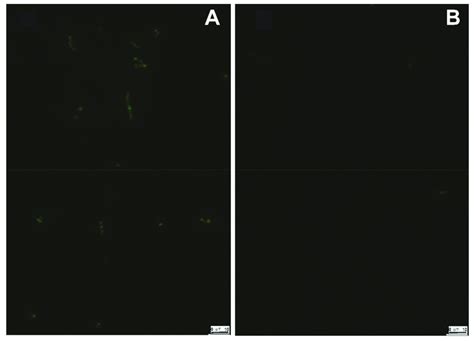 Fluorescence microscopy images of recombinant E. coli cells expressing ...