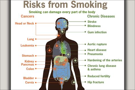 24"x36" Gallery Poster, health Risks from smoking cdc diagram cancer ...