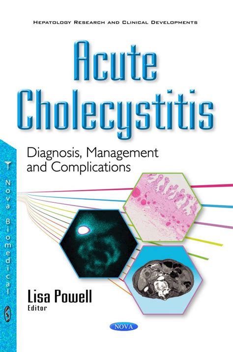 Acute Cholecystitis: Diagnosis, Management and Complications – Nova ...