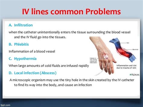 Iv fluid therapy (types, indications, doses calculation)