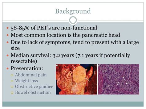 PPT - Neuroendocrine Tumors of the Pancreas PowerPoint Presentation ...