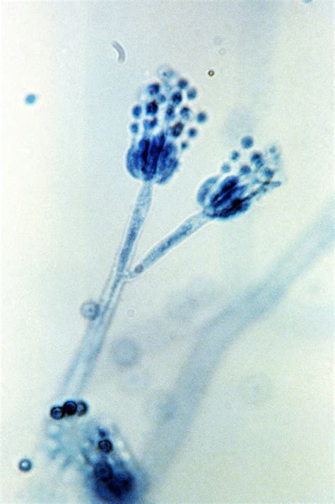 Public Domain Picture | Magnified at 1200x, this 1971 photomicrograph depicted two conidiophores ...