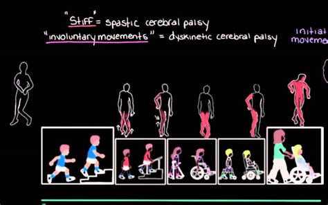 Khan Academy - Types of Cerebral Palsy Part 2: Dyskinetic & Ataxic - YouTube