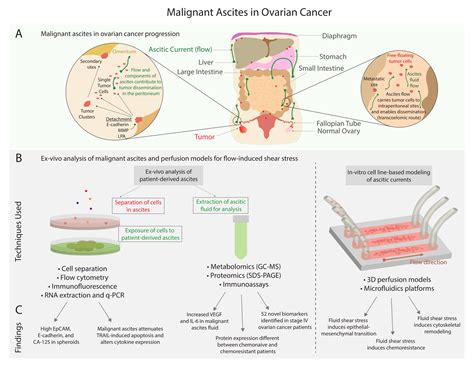 Cancers | Free Full-Text | Malignant Ascites in Ovarian Cancer ...