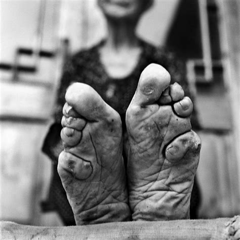 Powerful Photo Series Documents the Final Generation of Foot Binding in China - Feature Shoot