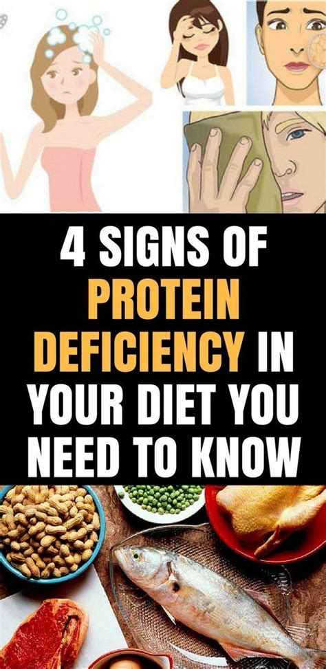 Here Are 4 Signs Of Protein Deficiency In Your Diet You Need To Know!!! - 101SHE | Low energy ...