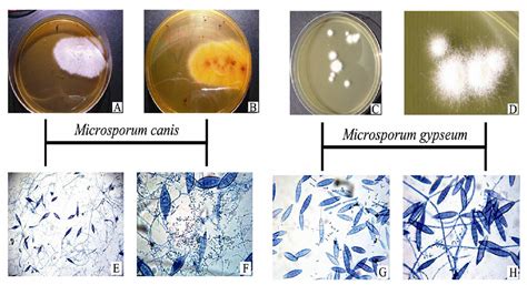 Microsporum Canis