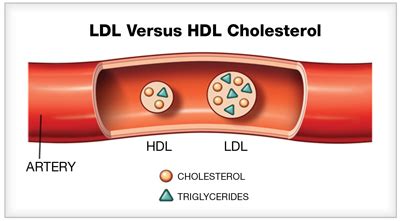 Structure and Function - 4.3.1 LDL/HDL NOAH RING