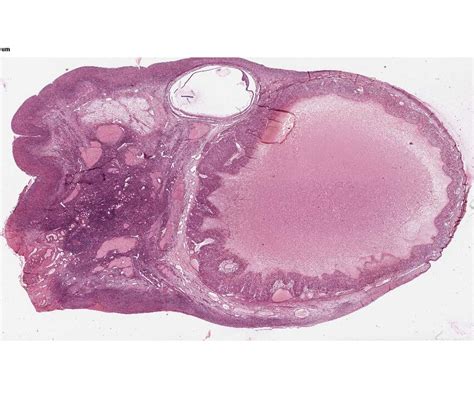 Graafian Follicle Histology Labeled