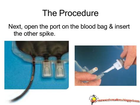 Blood Transfusion (a nursing procedure) by www.nursesinfosite.blogspo…