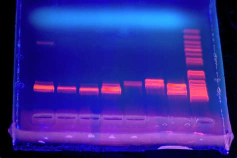 Dna Electrophoresis Under Uv Light by Science Photo Library