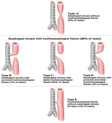 PediatricImaging - Riad-003-EAtandbrEAthe