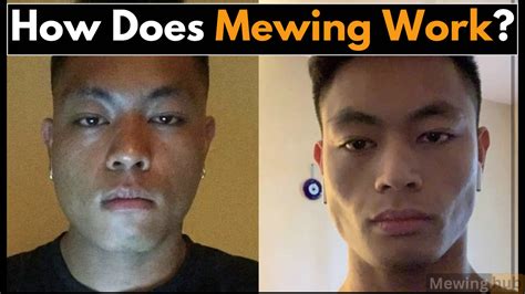 Mewing Before & After: 5 Incredible Transformations ! | Mewinghub