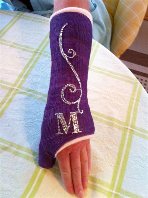 Jazz up your cast with some bling! | Arm cast, Cast decoration, Leg cast