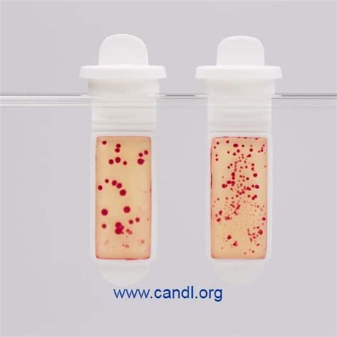 Dip Slides Test Kit – ECHA Microbiology