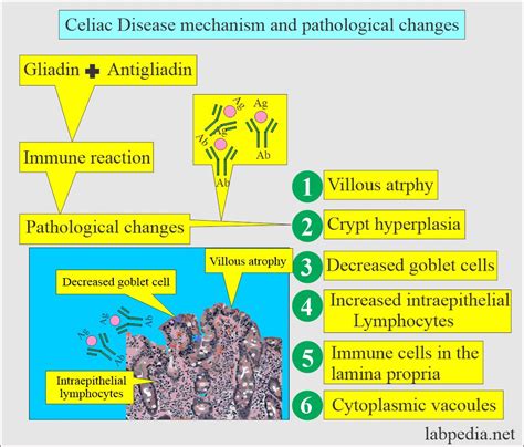 Gliadin Antibodies IgA, IgG (Endomysial antibodies)...